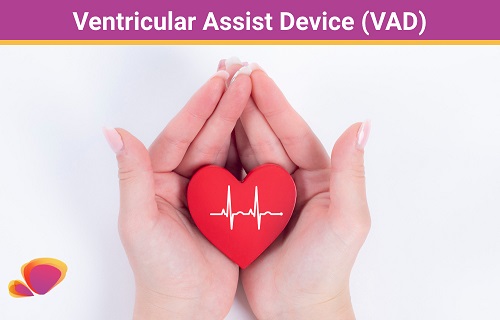 Ventricular Assist Device (VAD)