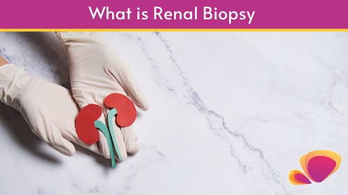 What is Renal Biopsy